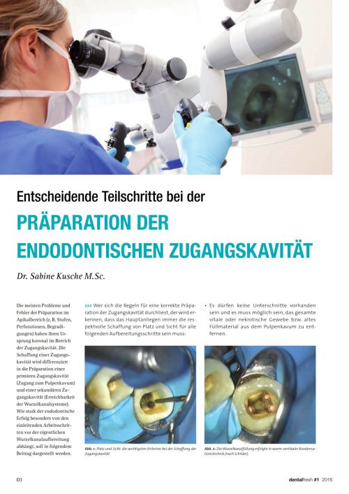 FB Biokeramische Sealer › Komet Magazin