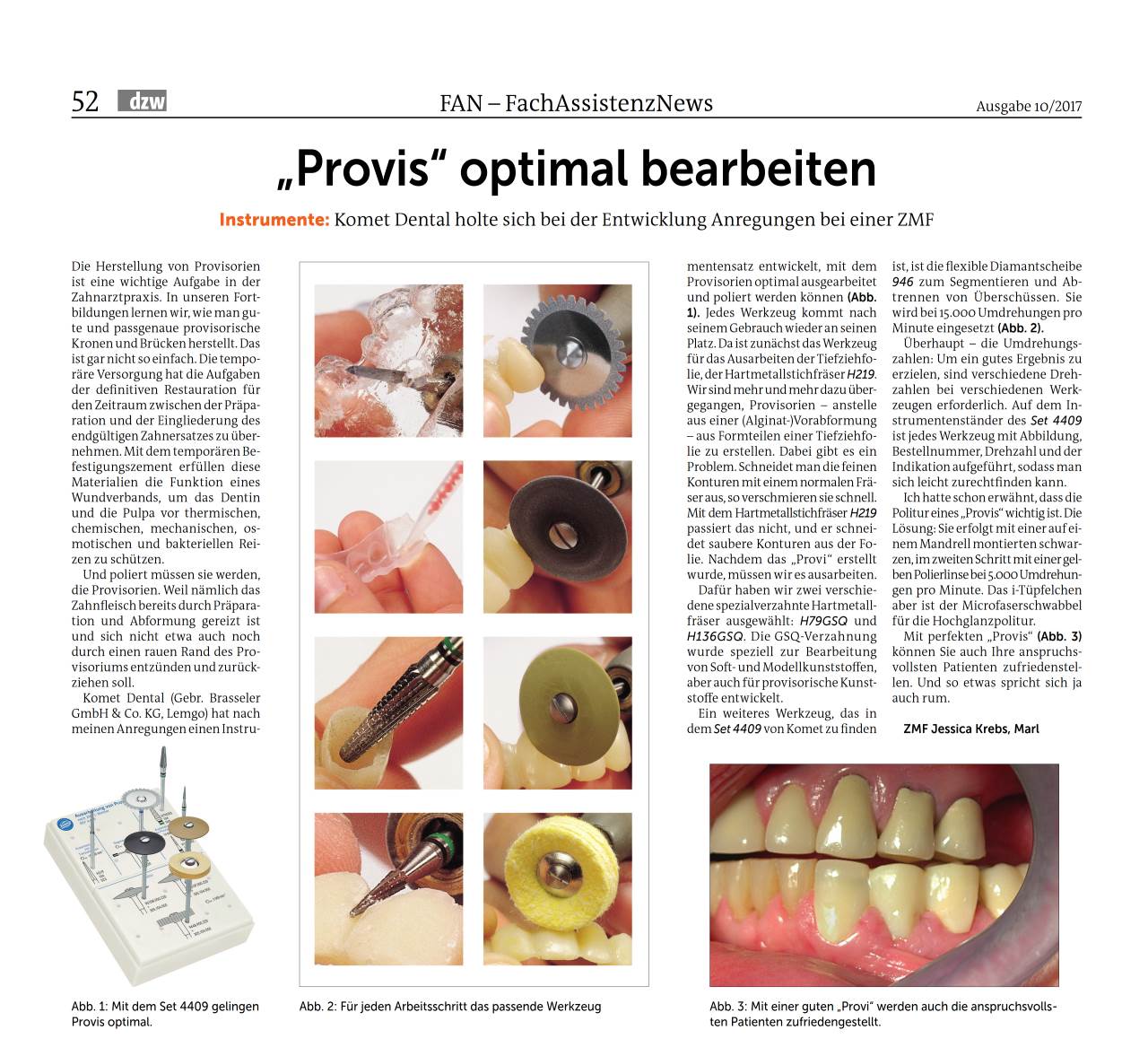 Fb provis optimal bearbeiten komet magazin