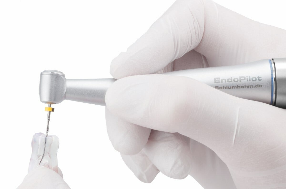 Gut motorisiert durch die Endo mit dem EndoPilot. › Komet Magazin